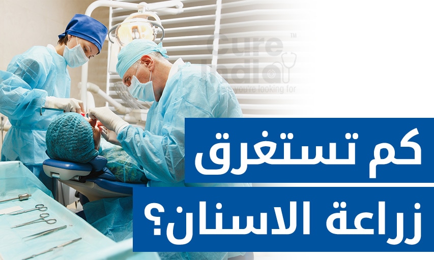كم تستغرق زراعة الاسنان؟ الوقت المطلوب في خطوات زراعة الأسنان